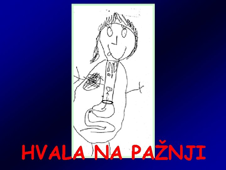 HVALA NA PAŽNJI HVALA NA PAŽNJI
