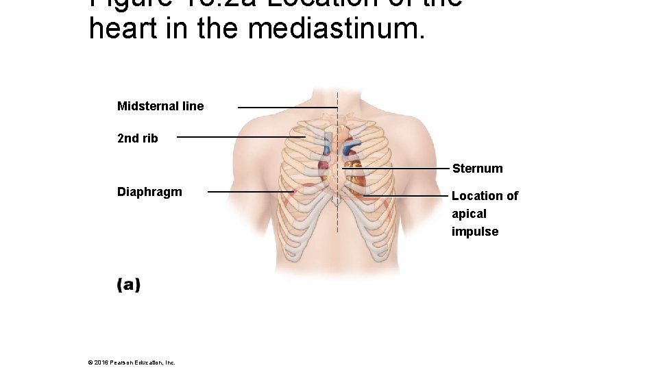 Figure 18. 2 a Location of the heart in the mediastinum. Midsternal line 2