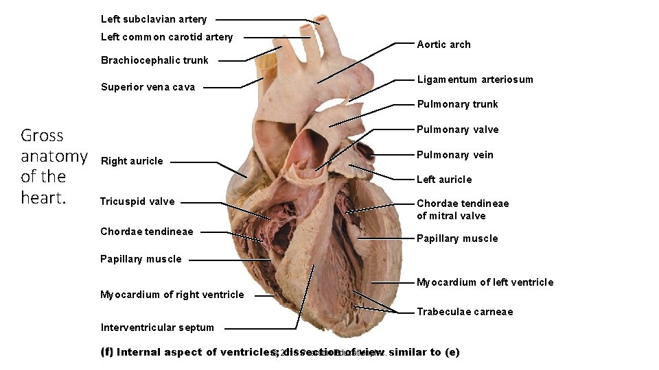 Left subclavian artery Left common carotid artery Aortic arch Brachiocephalic trunk Superior vena cava