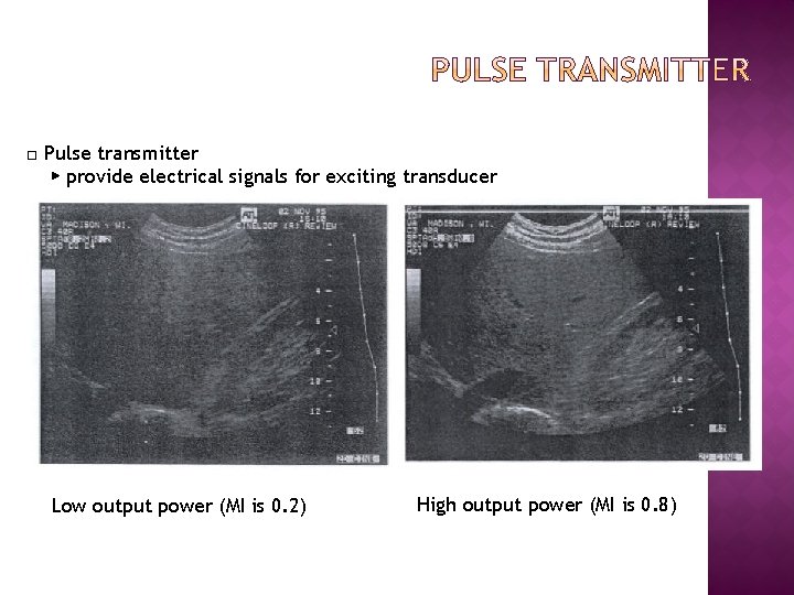 □ Pulse transmitter ▶ provide electrical signals for exciting transducer Low output power (MI