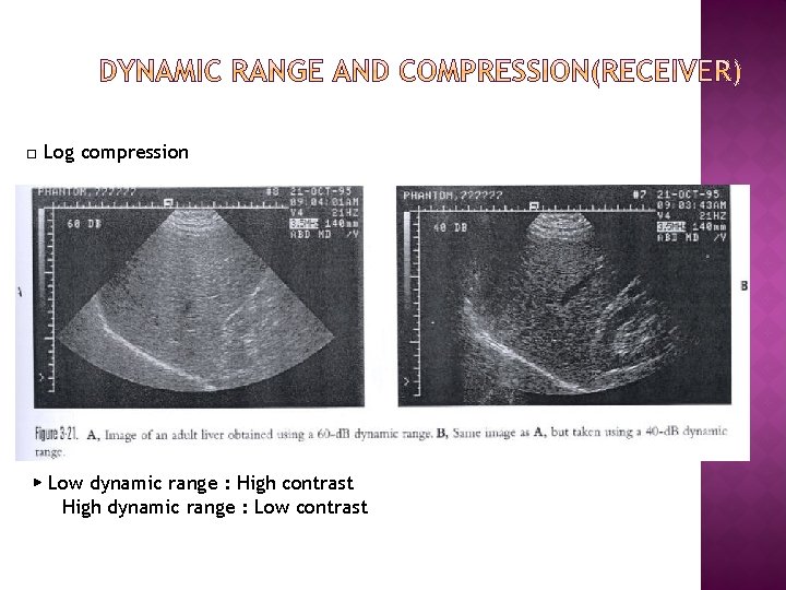 □ Log compression ▶ Low dynamic range : High contrast High dynamic range :