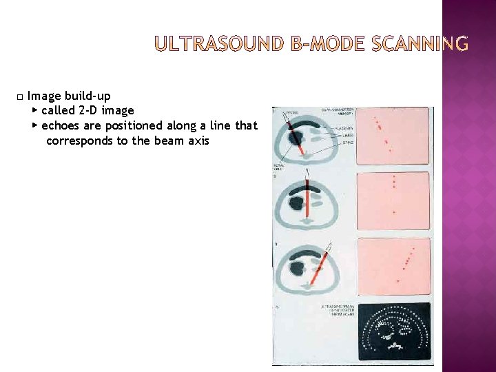 □ Image build-up ▶ called 2 -D image ▶ echoes are positioned along a