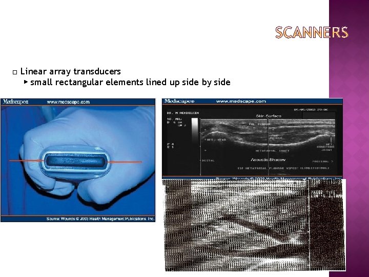 □ Linear array transducers ▶ small rectangular elements lined up side by side 