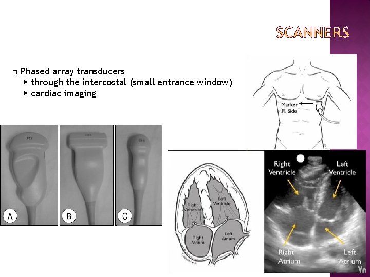 □ Phased array transducers ▶ through the intercostal (small entrance window) ▶ cardiac imaging