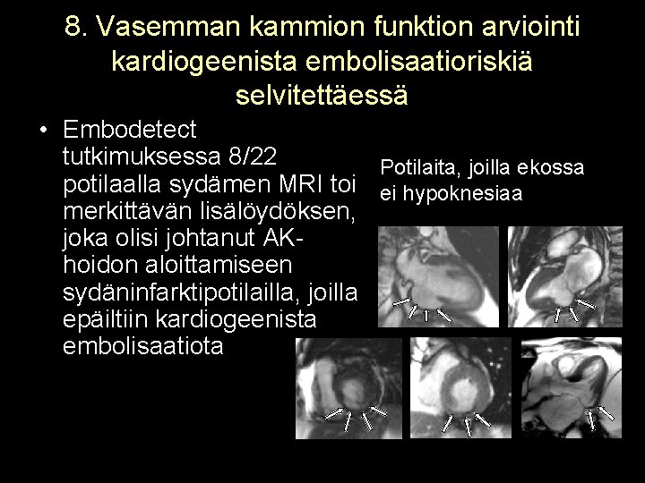 8. Vasemman kammion funktion arviointi kardiogeenista embolisaatioriskiä selvitettäessä • Embodetect tutkimuksessa 8/22 Potilaita, joilla