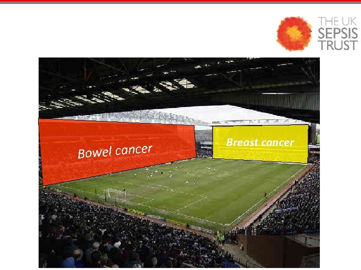 Bowel cancer Breast cancer 