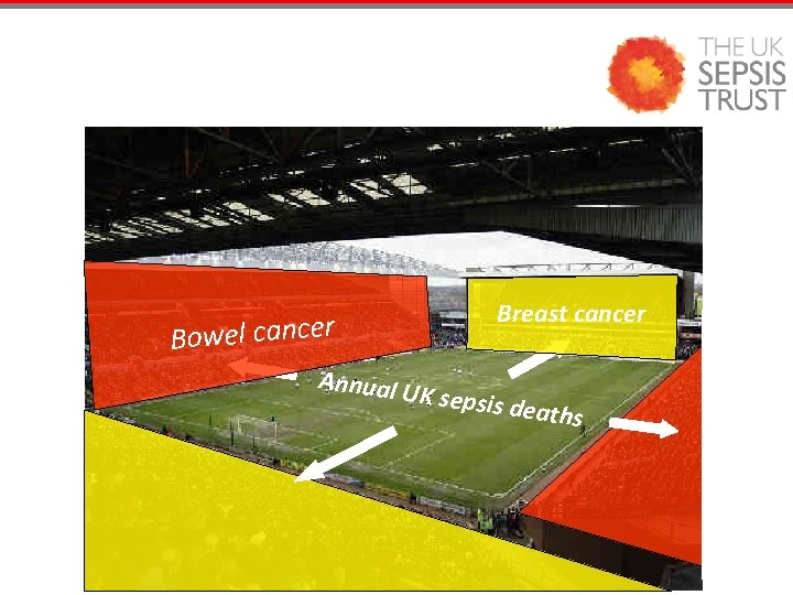 Breast cancer Bowel cancer Annual U K sepsis d eaths 