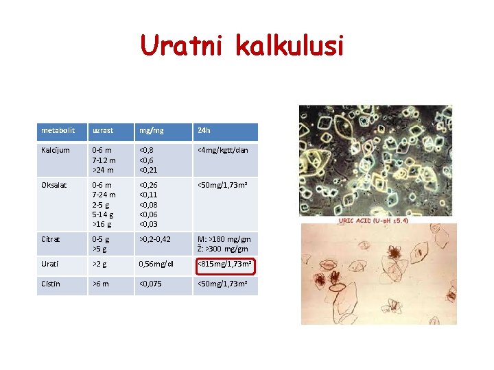 Uratni kalkulusi metabolit uzrast mg/mg 24 h Kalcijum 0 -6 m 7 -12 m