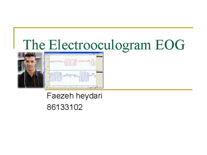 The Electrooculogram EOG Faezeh heydari 86133102 