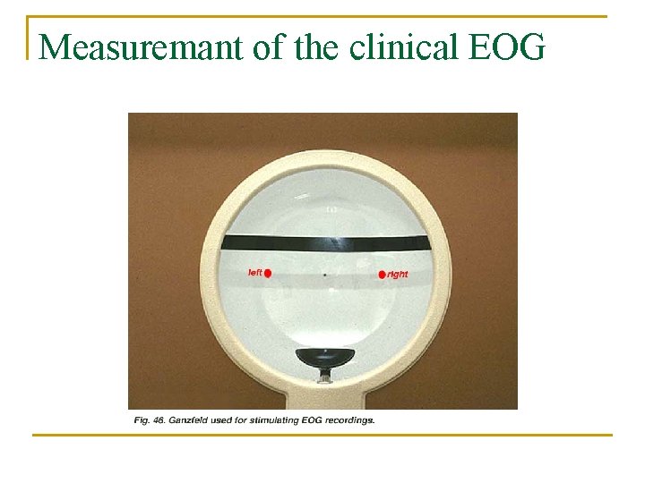 Measuremant of the clinical EOG 