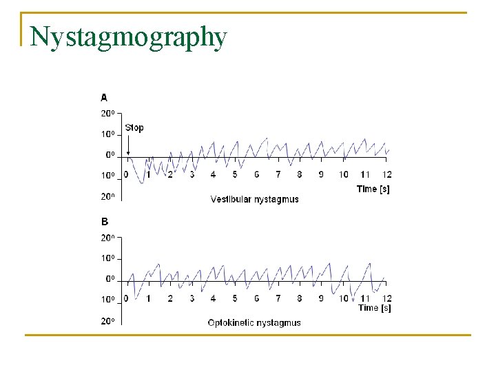Nystagmography 