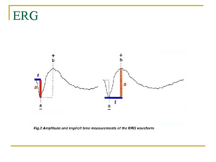 ERG 