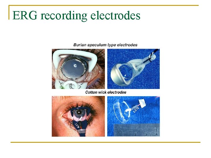 ERG recording electrodes 
