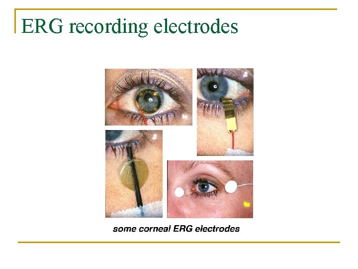 ERG recording electrodes 
