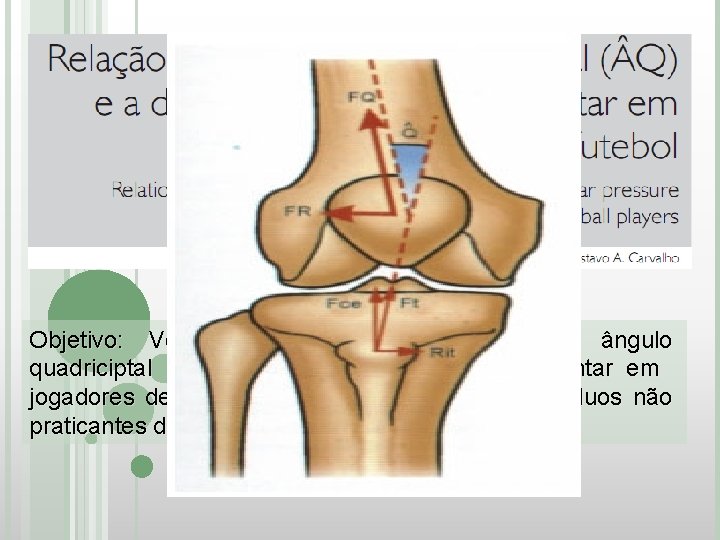 Objetivo: Verificar possível associação entre ângulo quadriciptal ( Q) e distribuição de pressão plantar