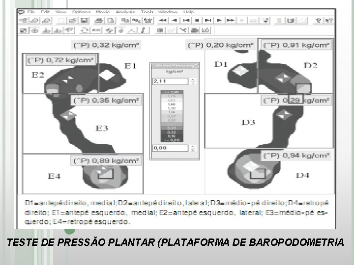 TESTE DE PRESSÃO PLANTAR (PLATAFORMA DE BAROPODOMETRIA 