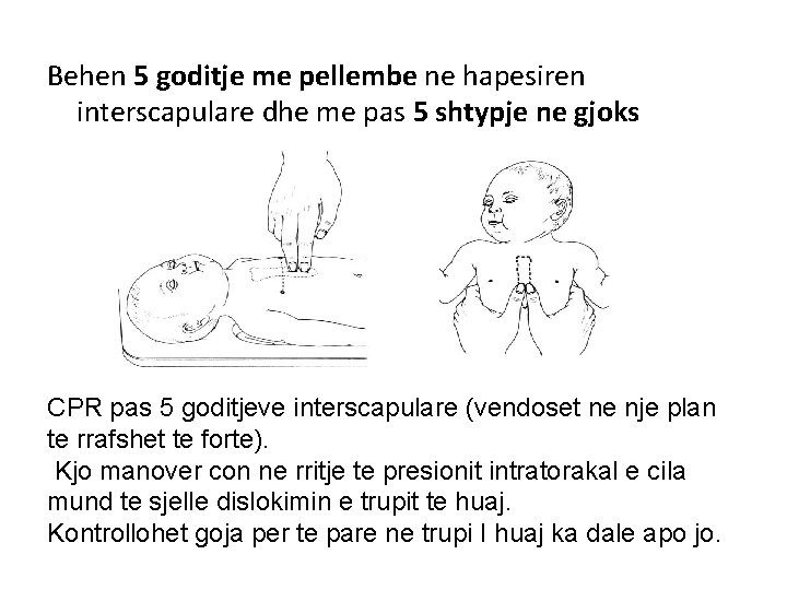 Behen 5 goditje me pellembe ne hapesiren interscapulare dhe me pas 5 shtypje ne