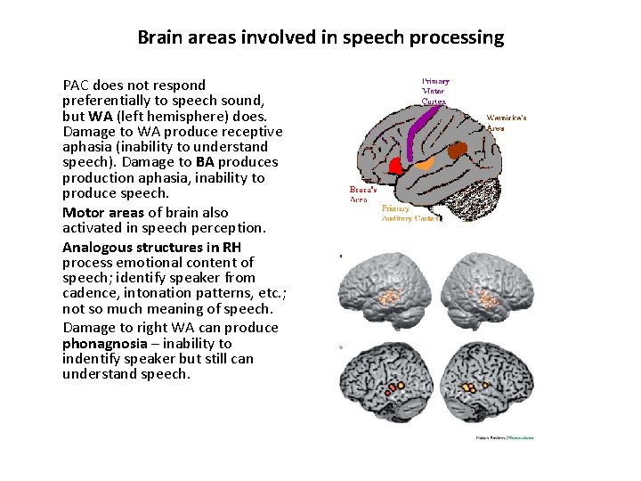 Brain areas involved in speech processing PAC does not respond preferentially to speech sound,