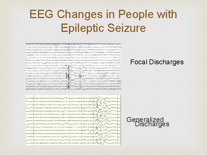 EEG Changes in People with Epileptic Seizure Focal Discharges Generalized Discharges 