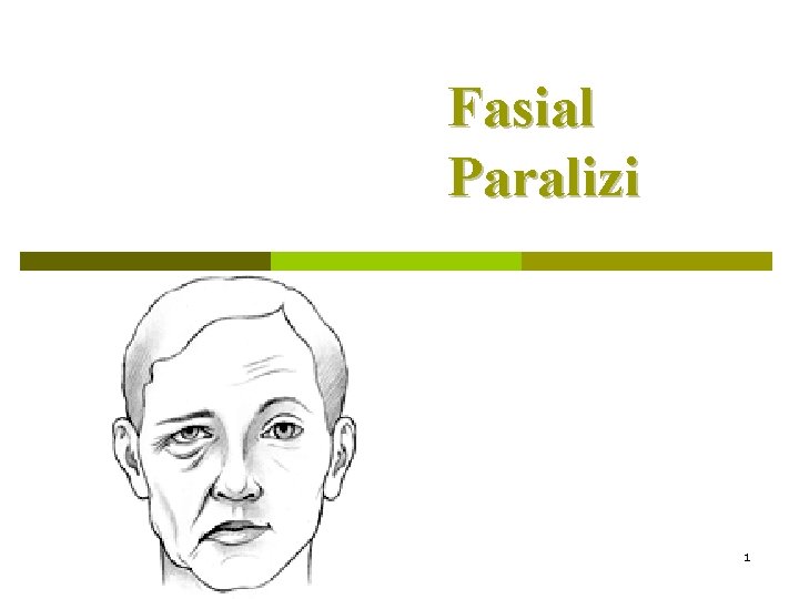 Fasial Paralizi 1 