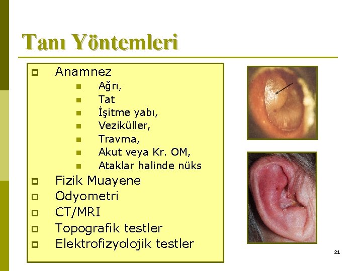 Tanı Yöntemleri p Anamnez n n n n p p p Ağrı, Tat İşitme