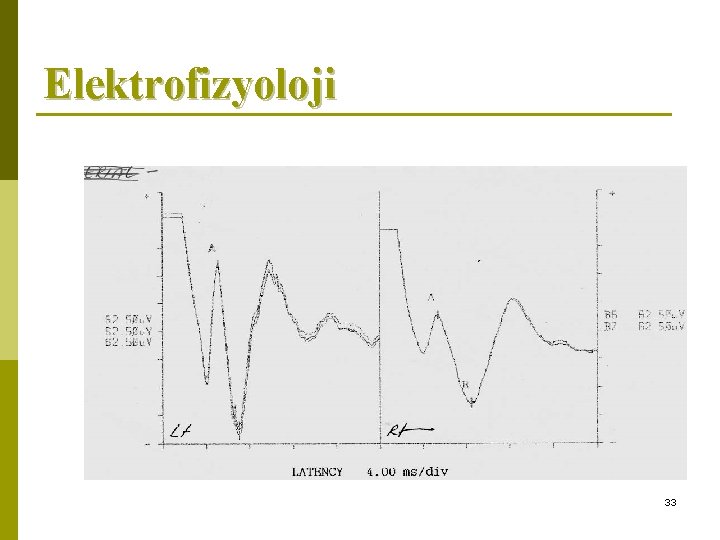 Elektrofizyoloji 33 