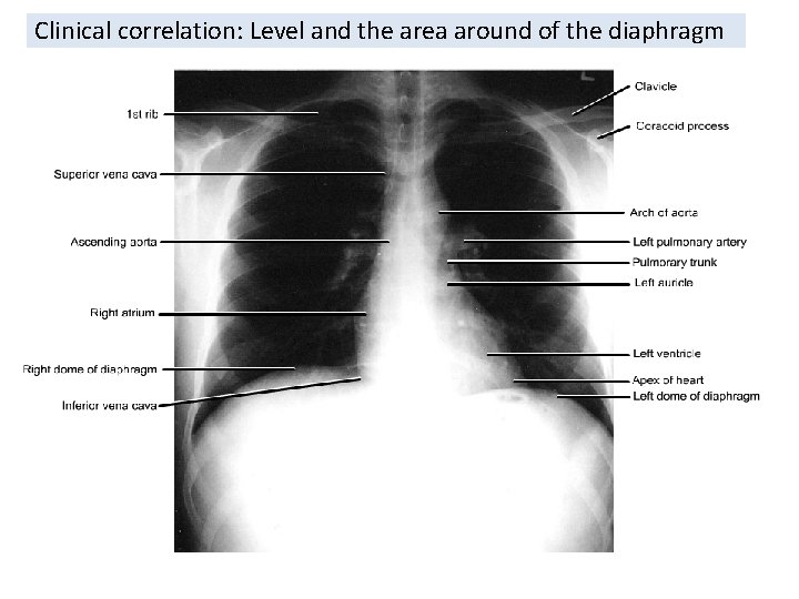 Clinical correlation: Level and the area around of the diaphragm Clinical correlation: Level and the area around of the diaphragm