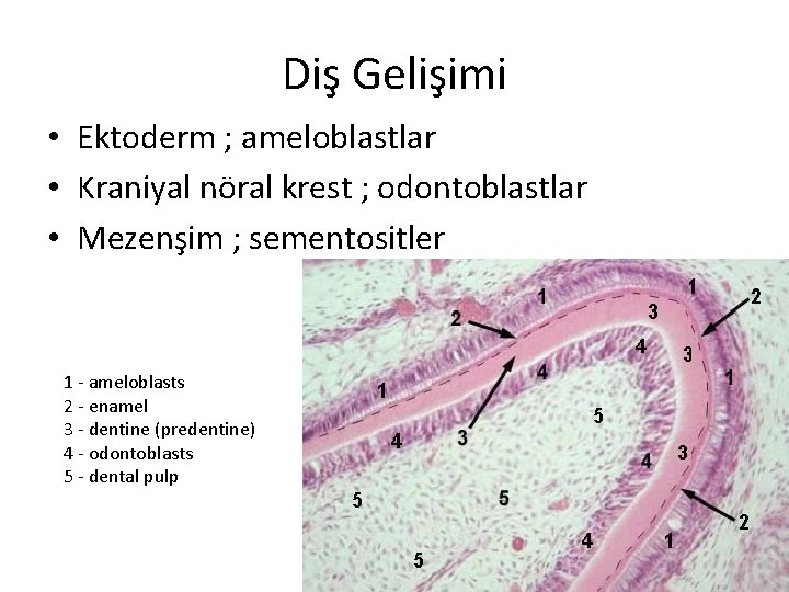 Diş Gelişimi • Ektoderm ; ameloblastlar • Kraniyal nöral krest ; odontoblastlar • Mezenşim