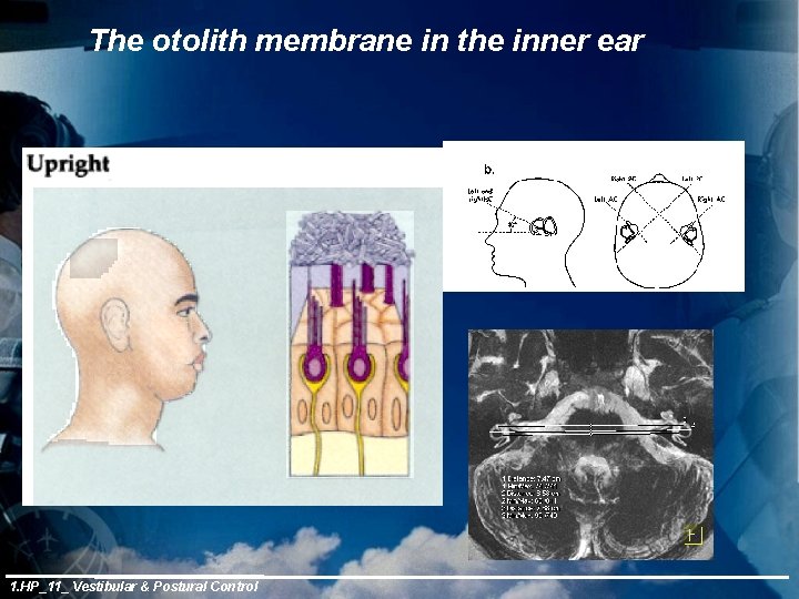 The otolith membrane in the inner ear 1. HP_11_ Vestibular & Postural Control 