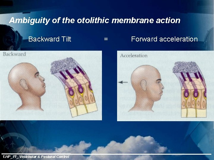 Ambiguity of the otolithic membrane action Backward Tilt 1. HP_11_ Vestibular & Postural Control
