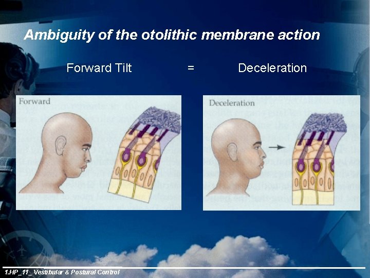 Ambiguity of the otolithic membrane action Forward Tilt 1. HP_11_ Vestibular & Postural Control