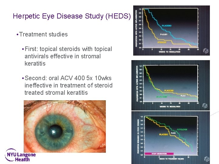 Herpetic Eye Disease Study (HEDS) • Treatment studies • First: topical steroids with topical