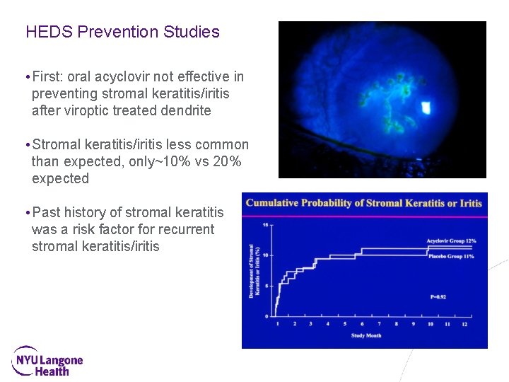 HEDS Prevention Studies • First: oral acyclovir not effective in preventing stromal keratitis/iritis after