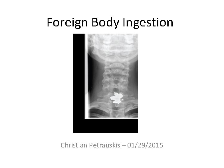 Foreign Body Ingestion Christian Petrauskis – 01/29/2015 