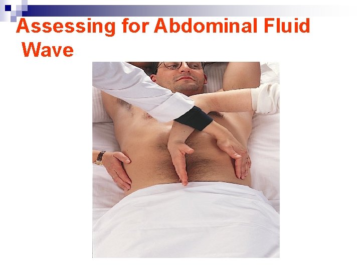 Assessing for Abdominal Fluid Wave 