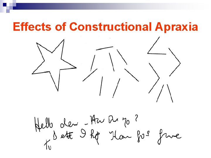 Effects of Constructional Apraxia 