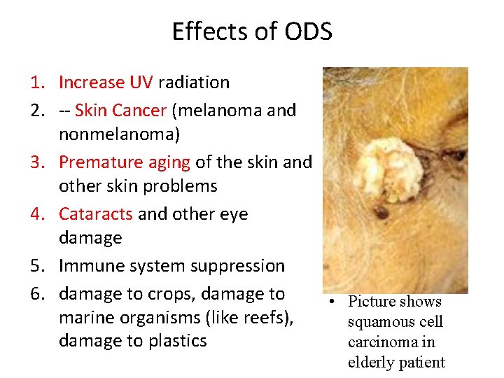 Effects of ODS 1. Increase UV radiation 2. -- Skin Cancer (melanoma and nonmelanoma)