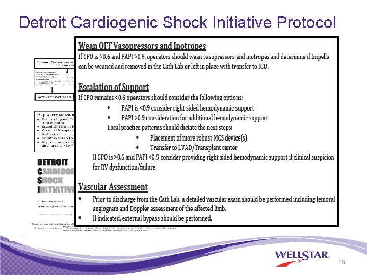 Detroit Cardiogenic Shock Initiative Protocol 19 