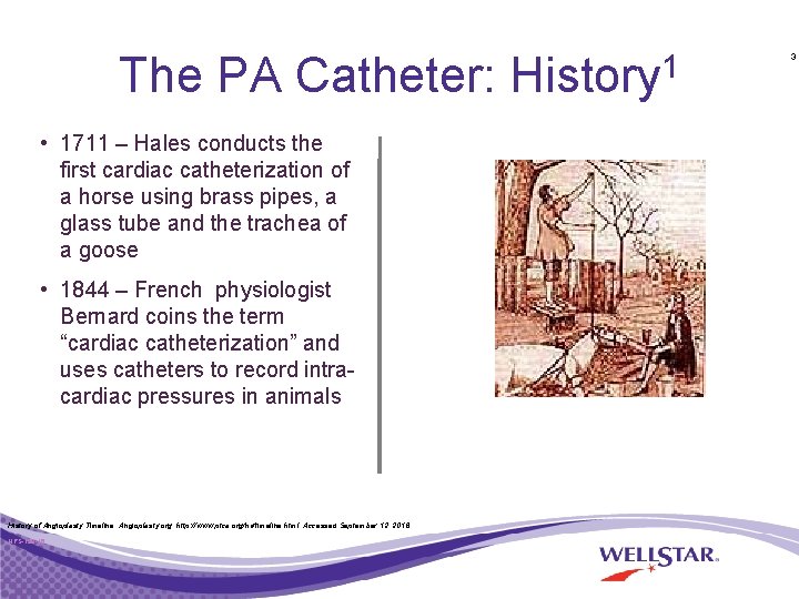The PA Catheter: History 1 • 1711 – Hales conducts the first cardiac catheterization