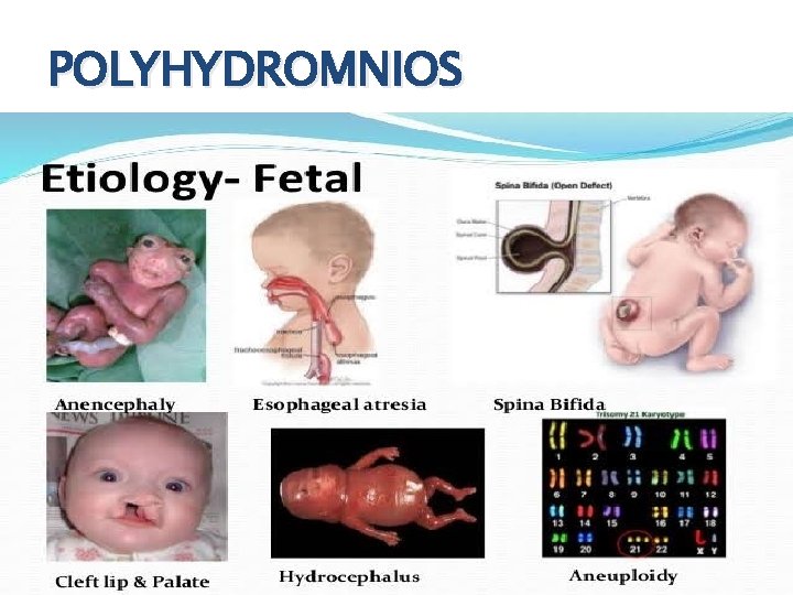POLYHYDROMNIOS 