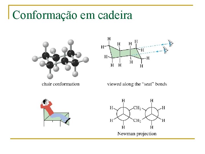 Conformação em cadeira 
