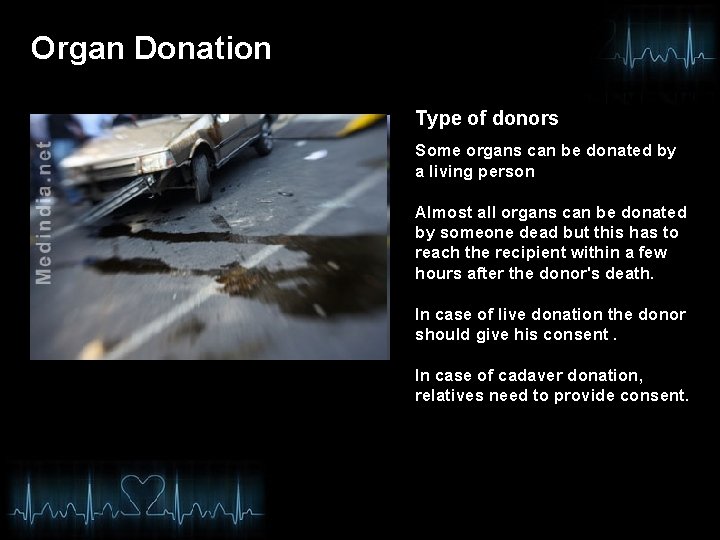 Organ Donation Type of donors Some organs can be donated by a living person