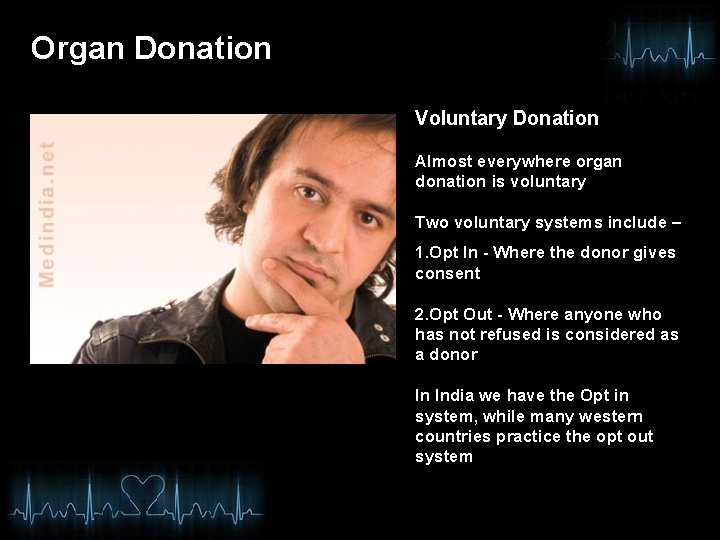 Organ Donation Voluntary Donation Almost everywhere organ donation is voluntary Two voluntary systems include