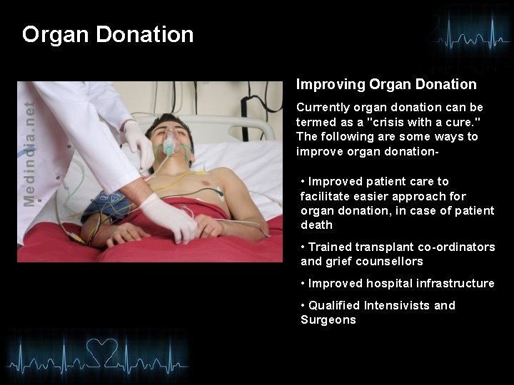 Organ Donation Improving Organ Donation Currently organ donation can be termed as a "crisis