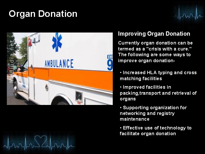 Organ Donation Improving Organ Donation Currently organ donation can be termed as a "crisis