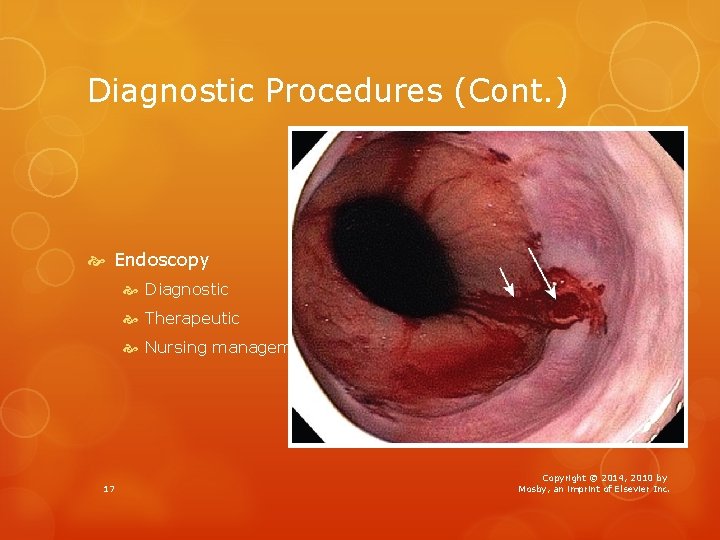 Diagnostic Procedures (Cont. ) Endoscopy Diagnostic Therapeutic Nursing management 17 Copyright © 2014, 2010