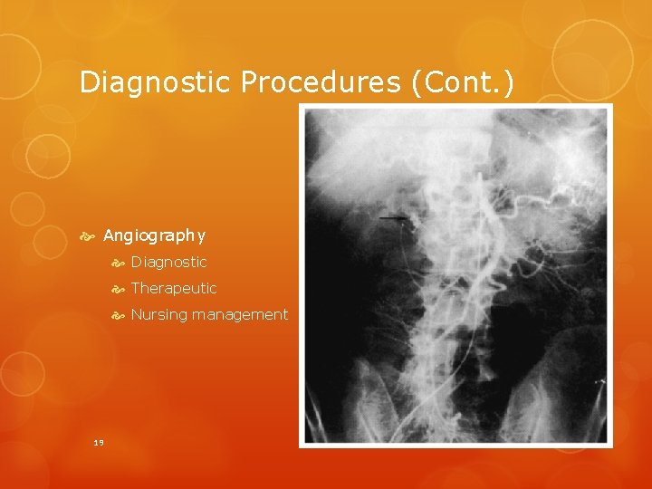 Diagnostic Procedures (Cont. ) Angiography Diagnostic Therapeutic Nursing management 19 Copyright © 2014, 2010