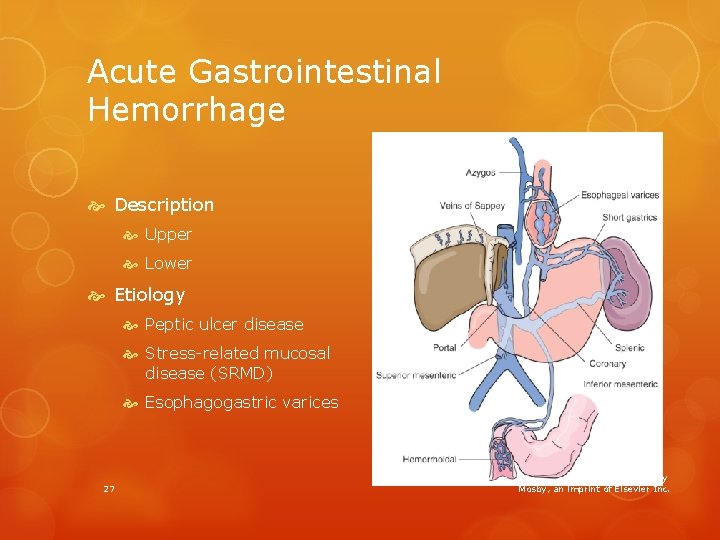 Acute Gastrointestinal Hemorrhage Description Upper Lower Etiology Peptic ulcer disease Stress-related mucosal disease (SRMD)