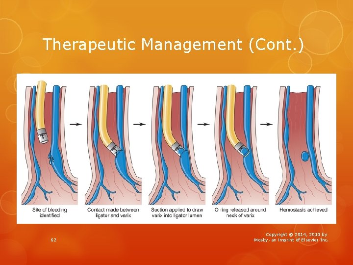 Therapeutic Management (Cont. ) 62 Copyright © 2014, 2010 by Mosby, an imprint of