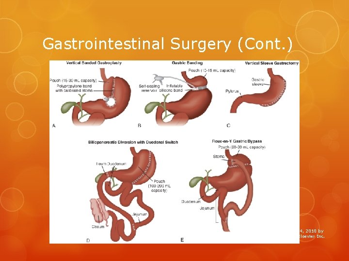 Gastrointestinal Surgery (Cont. ) 67 Copyright © 2014, 2010 by Mosby, an imprint of
